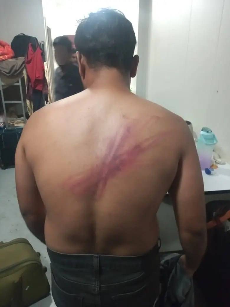 狗推警告‼️ 妙瓦底 盘总们